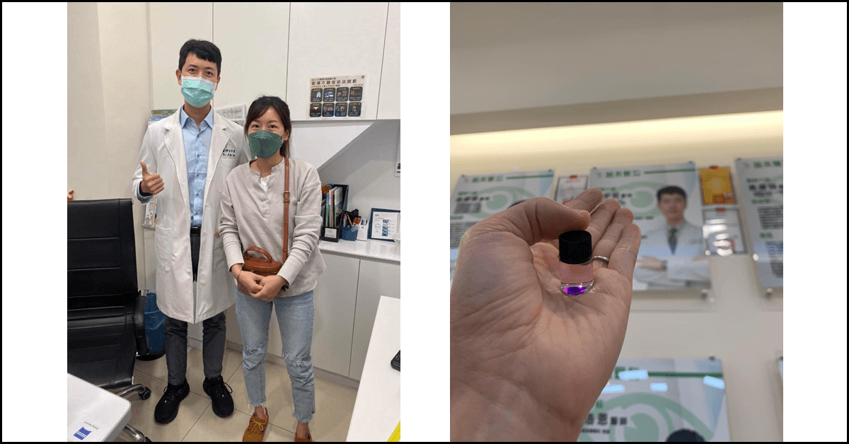 SMILE|原本不敢做,最後下定決心的手術前中後過程|心得分享